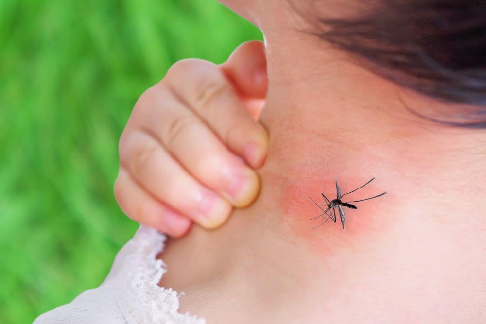 Mosquitoes Bites